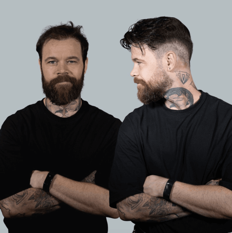 Balding to full hair transformation