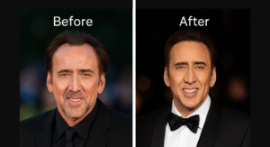 A side-by-side comparison of Nicolas Cage a hollywood celebrity with hair system