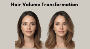 picture showing difference in women's hair volume after a hair system