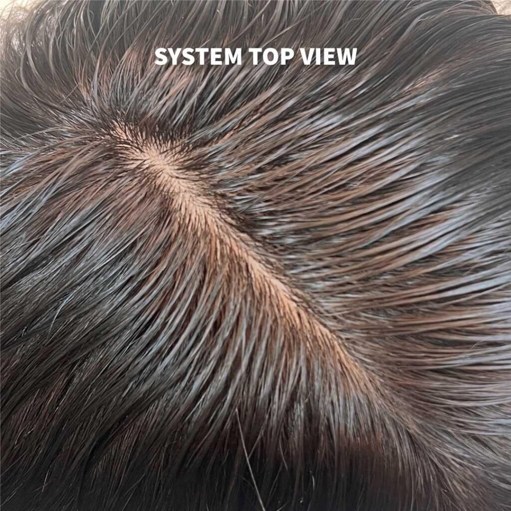 its a hair system from top view.